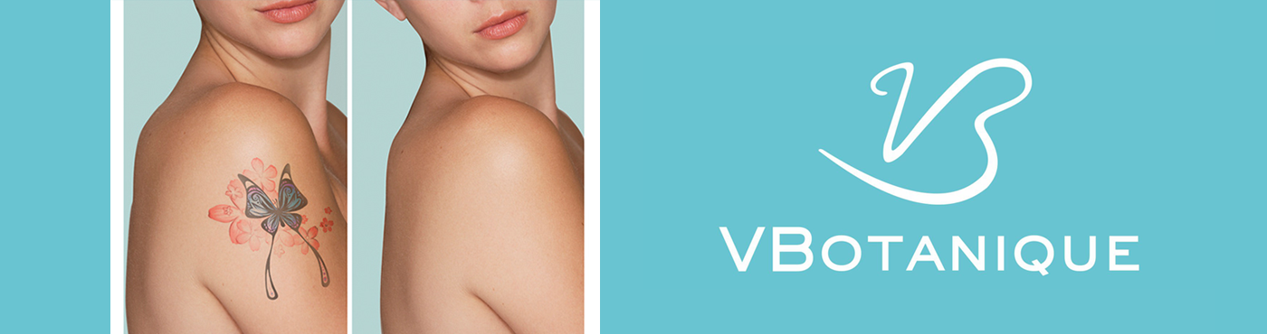 Laser Tattoo Removal - Vbotanique Beauty Cosmetics Clinic